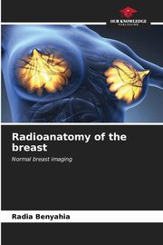 Radioanatomy of the breast, BENYAHIA Radia