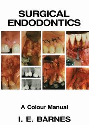 Surgical Endodontics, Barnes I.