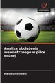 Analiza obcienia wewntrznego w pice nonej, Giovannelli Marco
