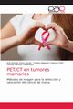 PET/CT en tumores mamarios, Serna Macias Jos Antonio