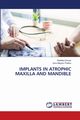 IMPLANTS IN ATROPHIC MAXILLA AND MANDIBLE, Grover Radhika