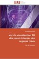 Vers la visualisation 3d des parois internes des organes creux, BEN-HAMADOU-A
