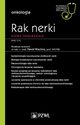 Rak nerki Wspczesne spojrzenie, 