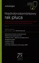 Niedrobnokomrkowy rak puca W gabinecie lekarza specjalisty, Krawczyk Pawe