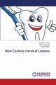 Non Carious Cervical Lesions, S. Gadia Priyanka