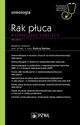 Rak puca Wspczesne podejcie, Ramlau Rodryg