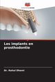 Les implants en prosthodontie, Dhami Dr. Rahul