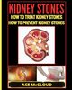 Kidney Stones, McCloud Ace
