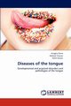 Diseases of the tongue, Shete Anagha
