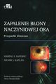 Zapalenie bony naczyniowej oka, Sandhu H.S., Kaplan H.J.