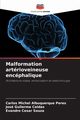Malformation artrioveineuse encphalique, Albuquerque Peres Carlos Michel