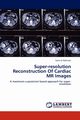 Super-resolution Reconstruction Of Cardiac MR Images, Rahman Sami Ur