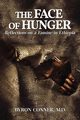 The Face of Hunger, Conner Byron