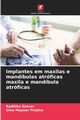Implantes em maxilas e mandbulas atrficas maxila e mandbula atrficas, Grover Radhika