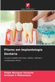 Pilares em Implantologia Dentria, Narayan Suvarna Shijal