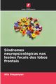 Sndromes neuropsicolgicas nas les?es focais dos lobos frontais, Stepanyan Alla
