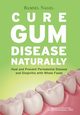 Cure Gum Disease Naturally, Nagel Ramiel