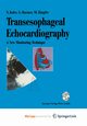 Transesophageal Echocardiography, Kolev Nikolai