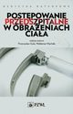 Postpowanie przedszpitalne w obraeniach ciaa, 