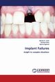 Implant Failures, Joshi Akshay D.