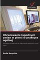 Obrazowanie agodnych zmian w piersi w praktyce oglnej, BENYAHIA Radia