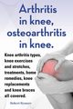 Arthritis in knee, osteoarthritis in knee. Knee arthritis types, knee exercises and stretches, treatments, home remedies, knee replacements and knee braces all covered., Rymore Robert