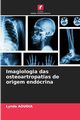 Imagiologia das osteoartropatias de origem endcrina, Aoudia Lynda
