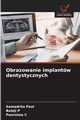 Obrazowanie implantw dentystycznych, Paul Samadrita