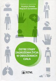 Ostre stany zagroenia ycia w obraeniach ciaa, 