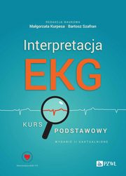 Interpretacja EKG, 