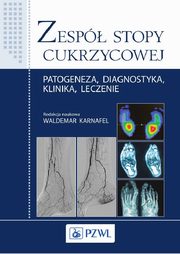 Zesp stopy cukrzycowej, Waldemar Karnafel