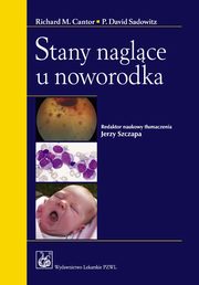 Stany naglce u noworodka, 