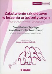 Zakotwienie szkieletowe w leczeniu ortodontycznym, Joanna Antoszewska-Smith, Moschos A. Papadopoulos, Nazan Kkkele, Hanife Nuray Yilmaz