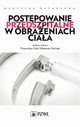 Postpowanie przedszpitalne w obraeniach ciaa, Przemysaw Gua, Waldemar Machaa