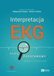 Interpretacja EKG, 